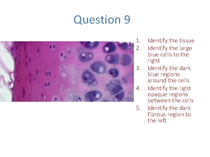 Question 9 1. 2. 3. 4. 5. Identify the tissue Identify the large blue