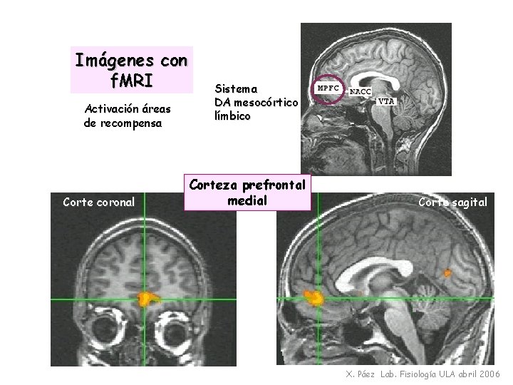 Imágenes con f. MRI Activación áreas de recompensa Corte coronal Sistema DA mesocórtico límbico