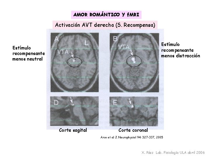 AMOR ROMÁNTICO YYf. MRI AMOR ROMÁNTICO Activación AVT derecha (S. Recompensa) Estímulo recompensante menos