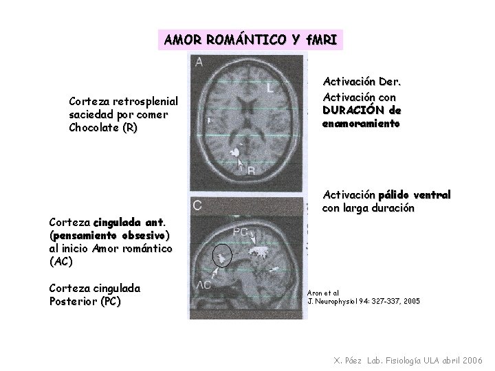 AMOR ROMÁNTICO Y f. MRI Corteza retrosplenial saciedad por comer Chocolate (R) Corteza cingulada