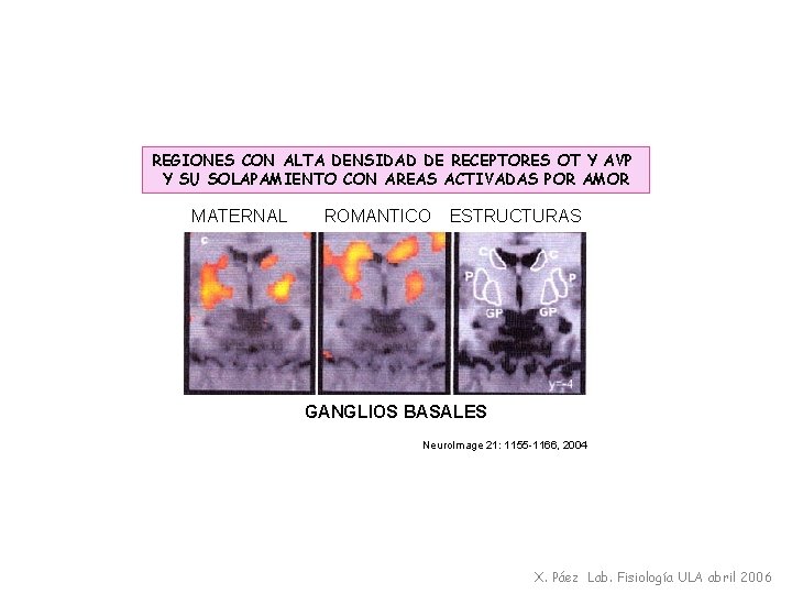 REGIONES CON ALTA DENSIDAD DE RECEPTORES OT Y AVP Y SU SOLAPAMIENTO CON AREAS