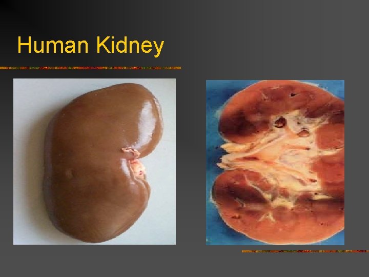 Human Kidney 