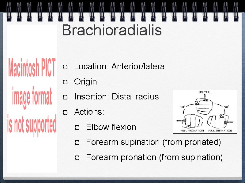 The Wrist Joint Muscles Muscles Elbow flexors anterior