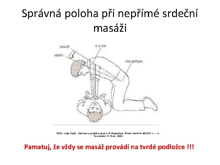 Správná poloha při nepřímé srdeční masáži MUDr. Juljo Hasík. Ilustrace a grafická úprav a: