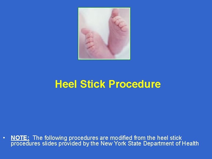 Heel Stick Procedure • NOTE: The following procedures are modified from the heel stick