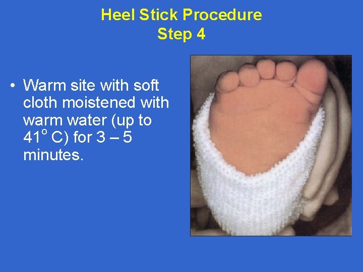 Heel Stick Procedure Step 4 • Warm site with soft cloth moistened with warm