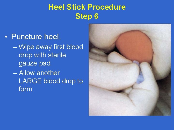 Heel Stick Procedure Step 6 • Puncture heel. – Wipe away first blood drop
