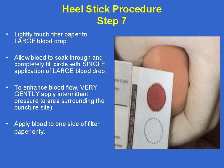 Heel Stick Procedure Step 7 • Lightly touch filter paper to LARGE blood drop.