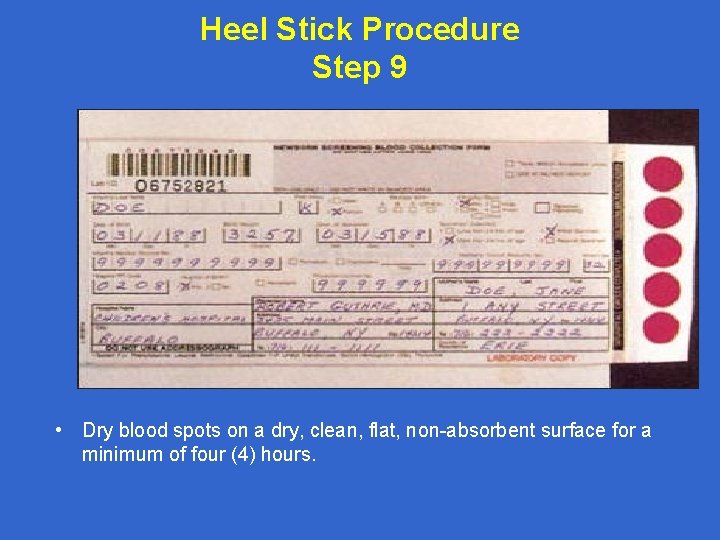 Heel Stick Procedure Step 9 • Dry blood spots on a dry, clean, flat,