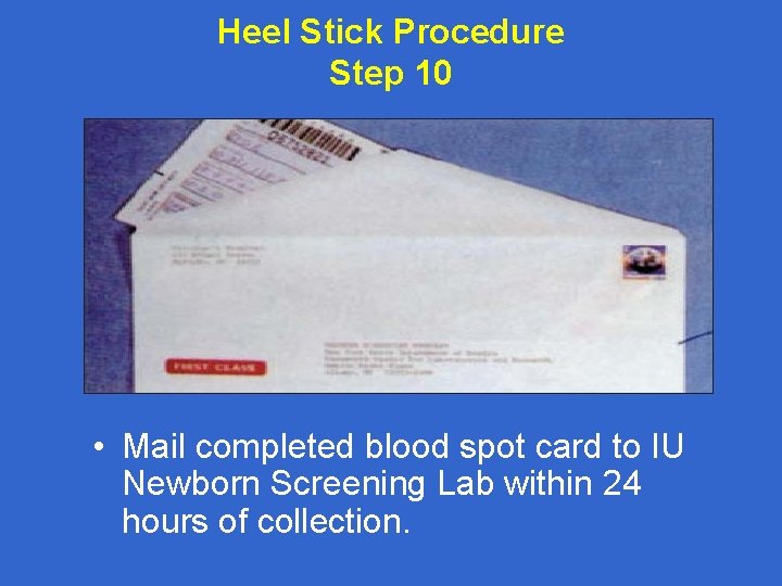 Heel Stick Procedure Step 10 • Mail completed blood spot card to IU Newborn