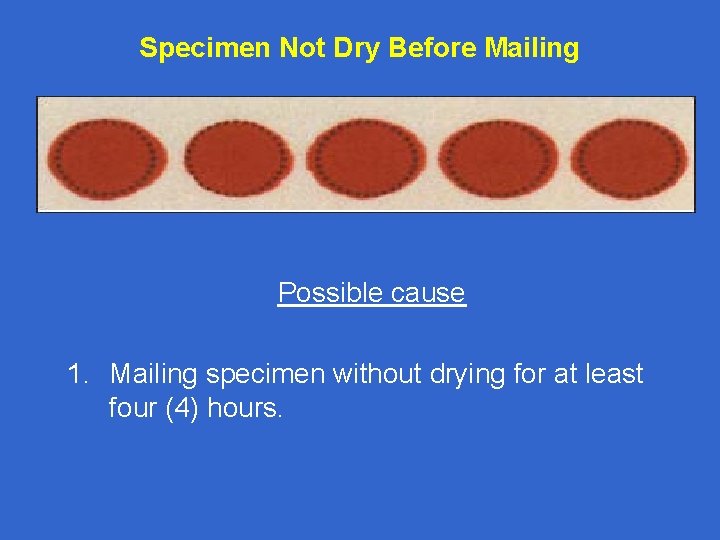 Specimen Not Dry Before Mailing Possible cause 1. Mailing specimen without drying for at