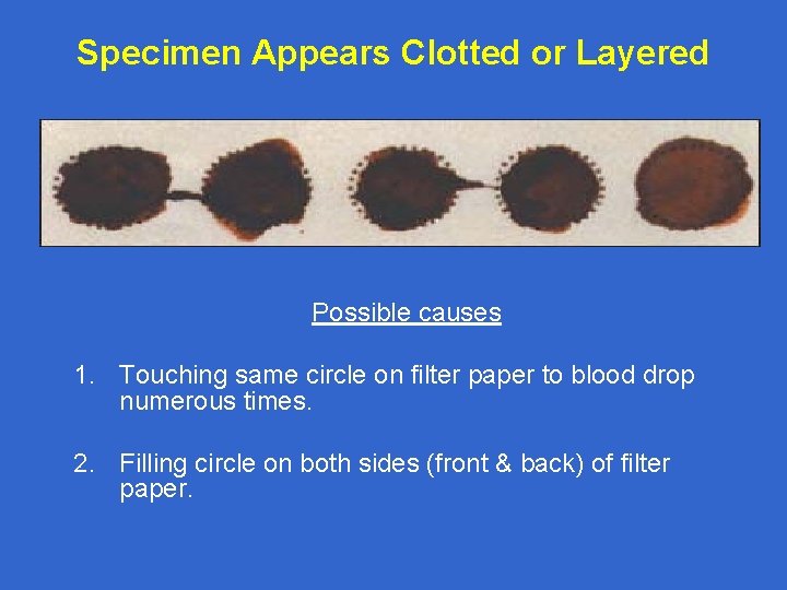 Specimen Appears Clotted or Layered Possible causes 1. Touching same circle on filter paper