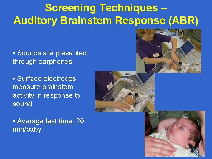 Screening Techniques – Auditory Brainstem Response (ABR) • Sounds are presented through earphones •