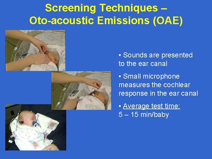 Screening Techniques – Oto-acoustic Emissions (OAE) • Sounds are presented to the ear canal