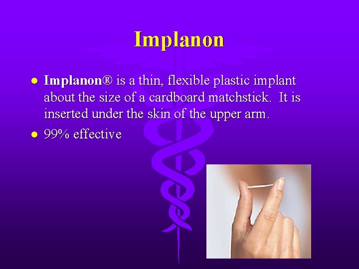 Implanon l l Implanon® is a thin, flexible plastic implant about the size of