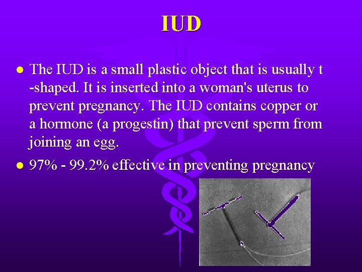 IUD l The IUD is a small plastic object that is usually t -shaped.