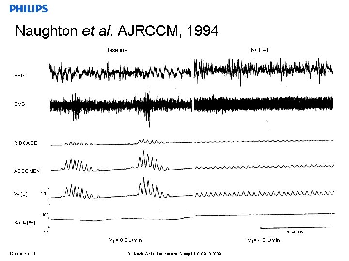 Naughton et al. AJRCCM, 1994 Baseline NCPAP EEG EMG RIBCAGE ABDOMEN VT (L) 1.