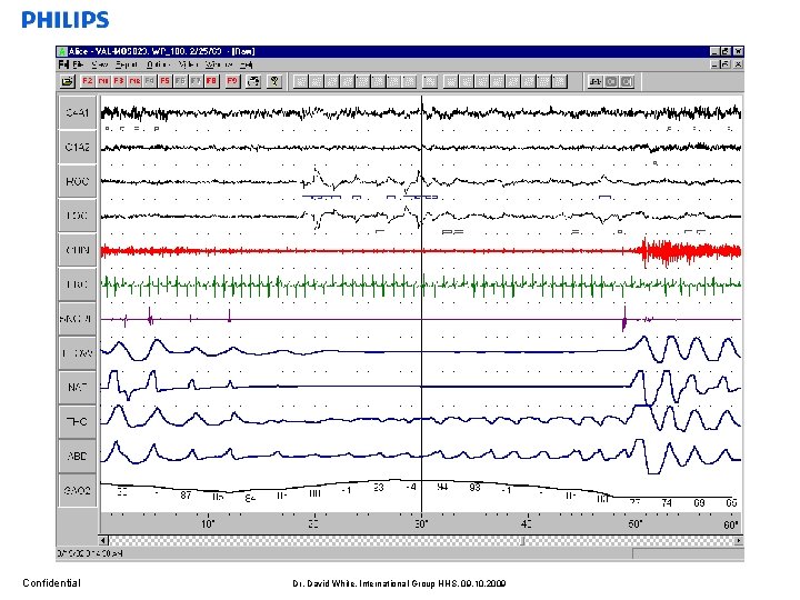 Confidential Dr. David White, International Group HHS, 09. 10. 2009 