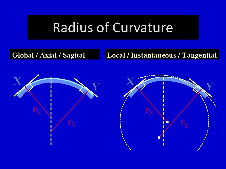 Radius of Curvature Global / Axial / Sagital X Local / Instantaneous / Tangential