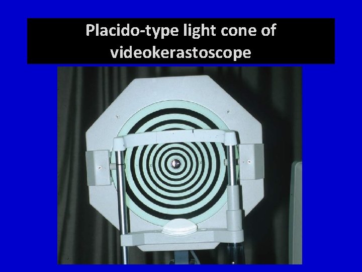 Placido-type light cone of videokerastoscope 