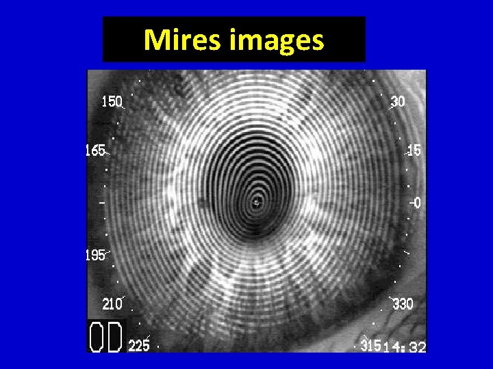Mires images 