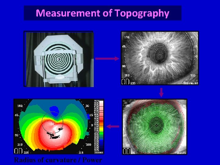 Measurement of Topography Radius of curvature / Power 