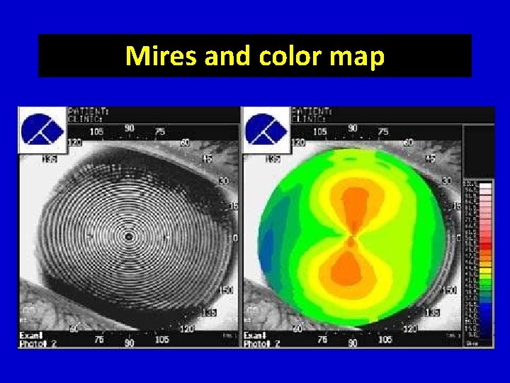 Mires and color map 