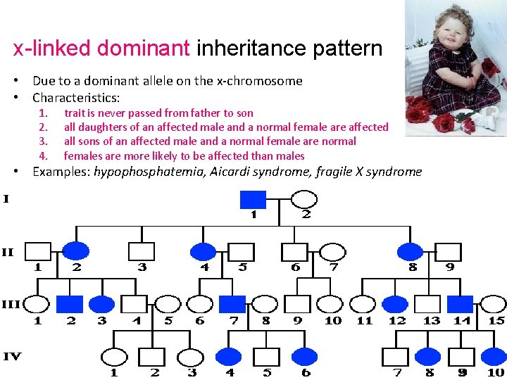 x-linked dominant inheritance pattern • Due to a dominant allele on the x-chromosome •