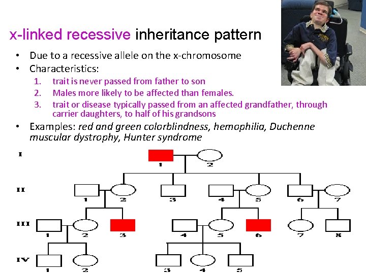 x-linked recessive inheritance pattern • Due to a recessive allele on the x-chromosome •