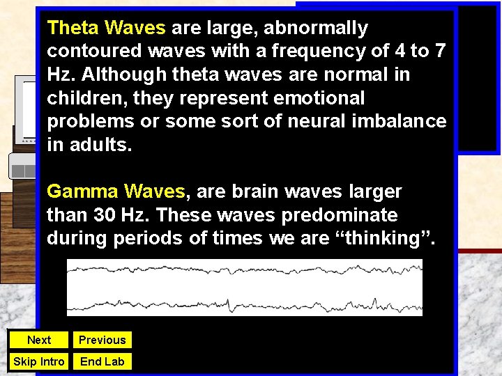 Theta Waves are large, abnormally contoured waves with a frequency of 4 to 7