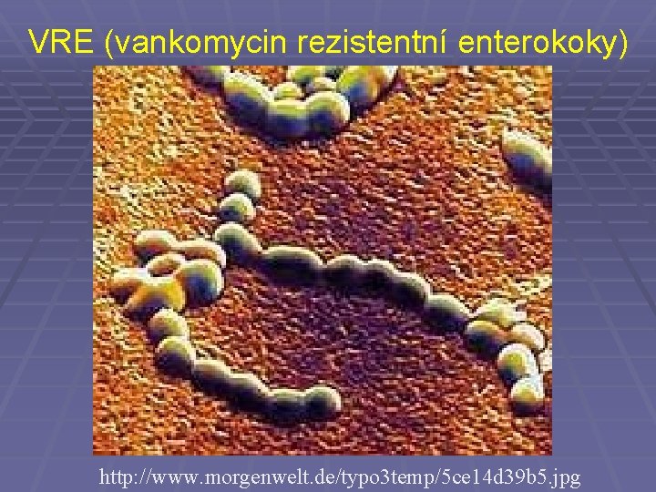 VRE (vankomycin rezistentní enterokoky) http: //www. morgenwelt. de/typo 3 temp/5 ce 14 d 39