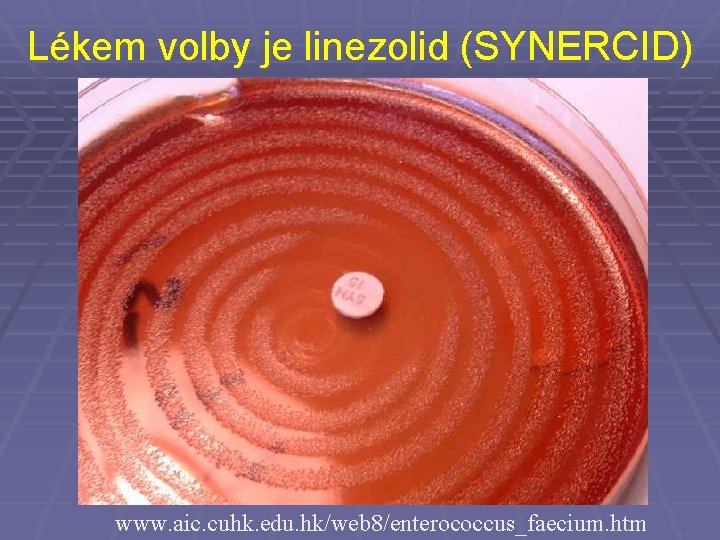 Lékem volby je linezolid (SYNERCID) www. aic. cuhk. edu. hk/web 8/enterococcus_faecium. htm 