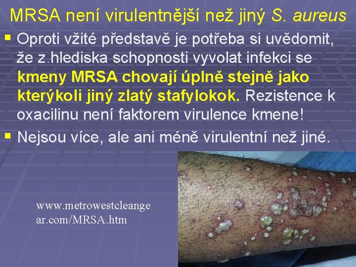 MRSA není virulentnější než jiný S. aureus § Oproti vžité představě je potřeba si