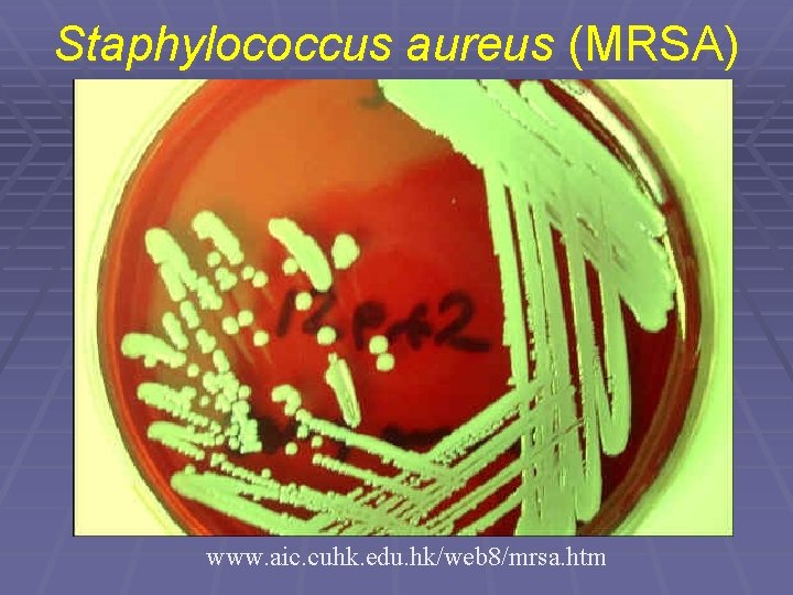 Staphylococcus aureus (MRSA) www. aic. cuhk. edu. hk/web 8/mrsa. htm 