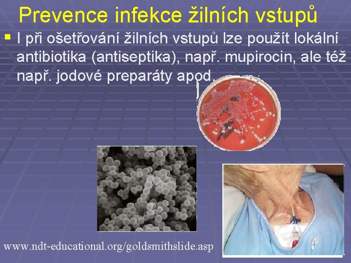 Prevence infekce žilních vstupů § I při ošetřování žilních vstupů lze použít lokální antibiotika