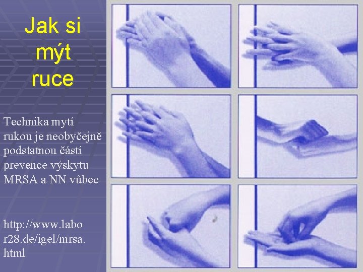 Jak si mýt ruce Technika mytí rukou je neobyčejně podstatnou částí prevence výskytu MRSA