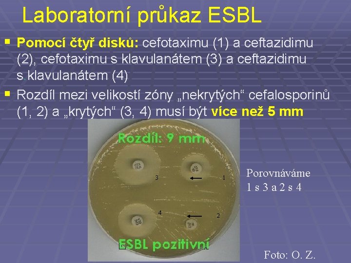 Laboratorní průkaz ESBL § Pomocí čtyř disků: cefotaximu (1) a ceftazidimu (2), cefotaximu s