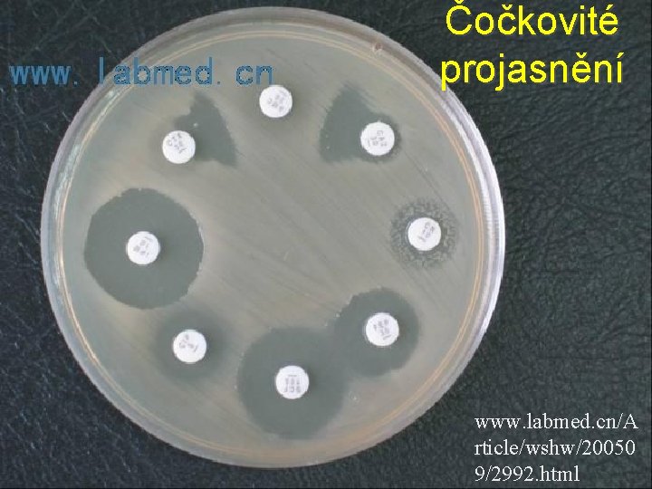 Čočkovité projasnění www. labmed. cn/A rticle/wshw/20050 9/2992. html 