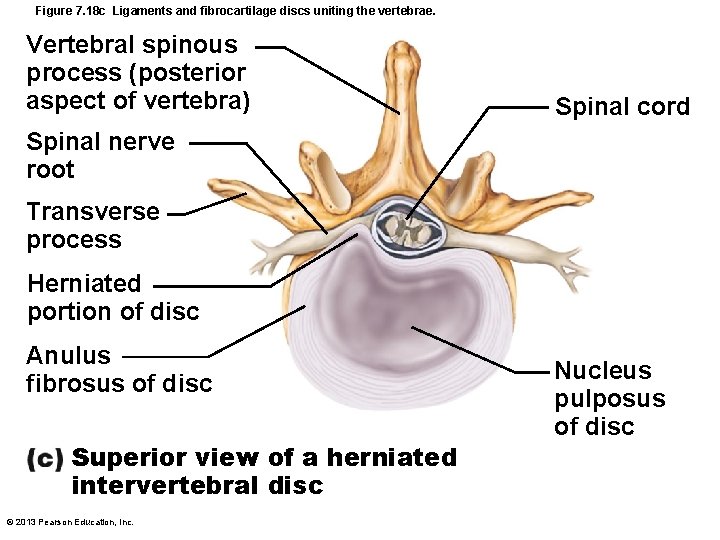 Figure 7. 18 c Ligaments and fibrocartilage discs uniting the vertebrae. Vertebral spinous process