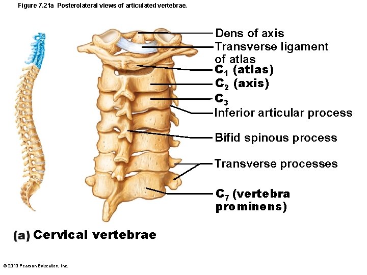 Figure 7. 21 a Posterolateral views of articulated vertebrae. Dens of axis Transverse ligament