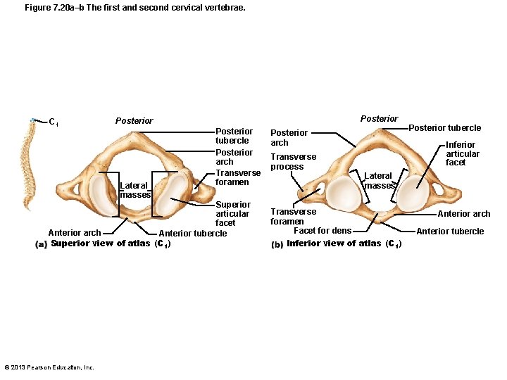 Figure 7. 20 a–b The first and second cervical vertebrae. C 1 Posterior Lateral