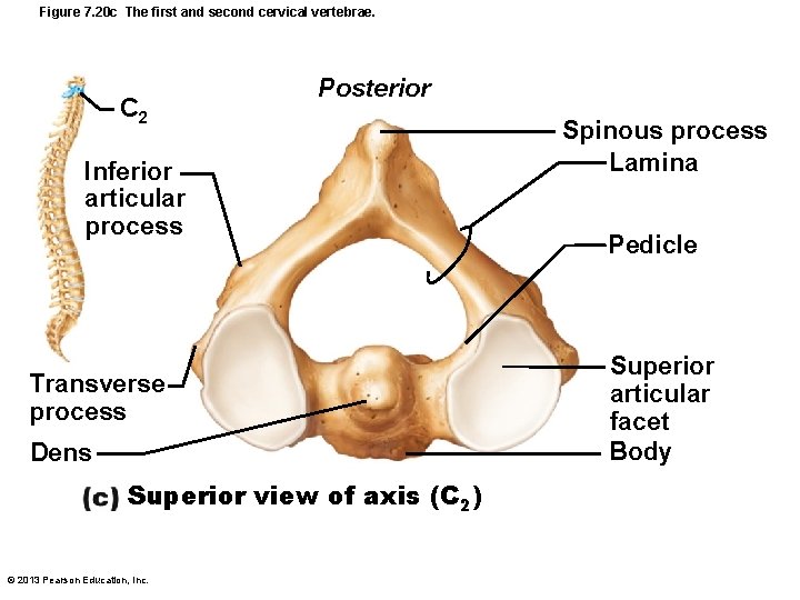 Figure 7. 20 c The first and second cervical vertebrae. C 2 Posterior Inferior