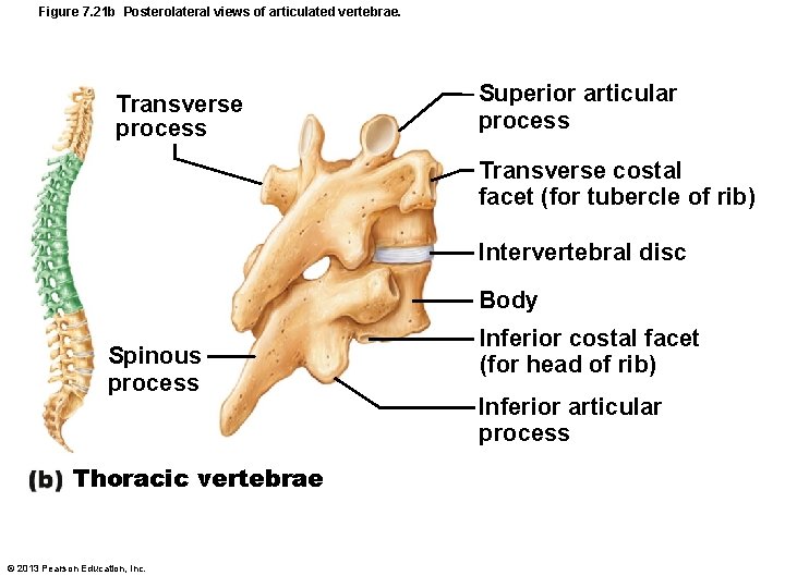 Figure 7. 21 b Posterolateral views of articulated vertebrae. Transverse process Superior articular process