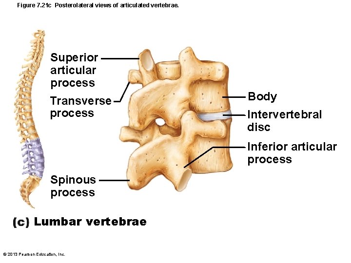Figure 7. 21 c Posterolateral views of articulated vertebrae. Superior articular process Transverse process