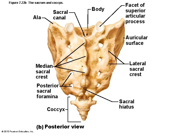 Figure 7. 22 b The sacrum and coccyx. Sacral canal Ala Body Facet of