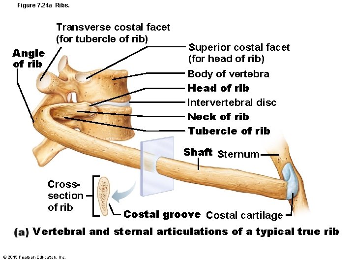 Figure 7. 24 a Ribs. Transverse costal facet (for tubercle of rib) Angle of