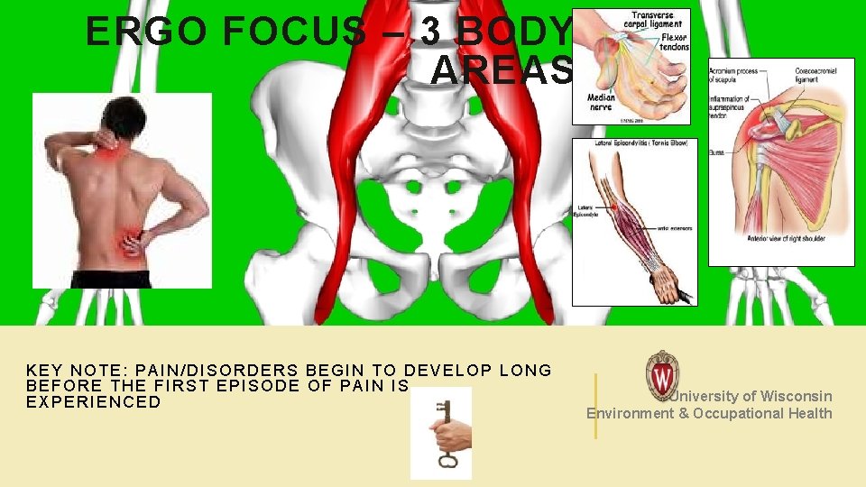 ERGO FOCUS – 3 BODY AREAS KEY NOTE: PAIN/DISORDERS BEGIN TO DEVELOP LONG BEFORE