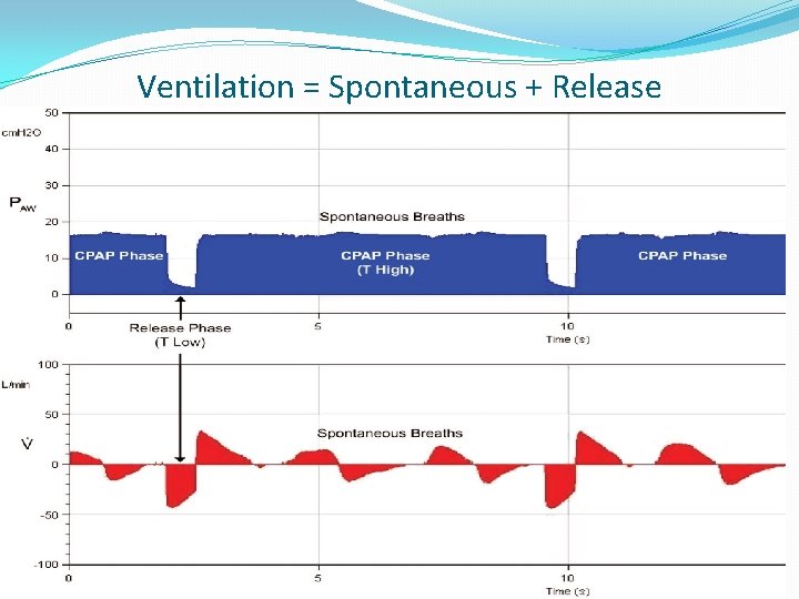 Ventilation = Spontaneous + Release 