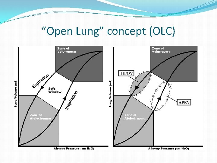 “Open Lung” concept (OLC) 