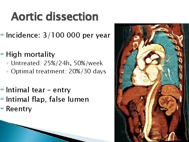 Aortic dissection Incidence: 3/100 000 per year High mortality ◦ Untreated: 25%/24 h, 50%/week